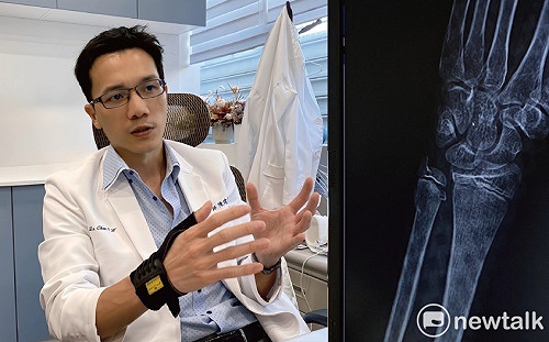 左手骨折配戴新型網狀輕透石膏  男童10天重回運動場