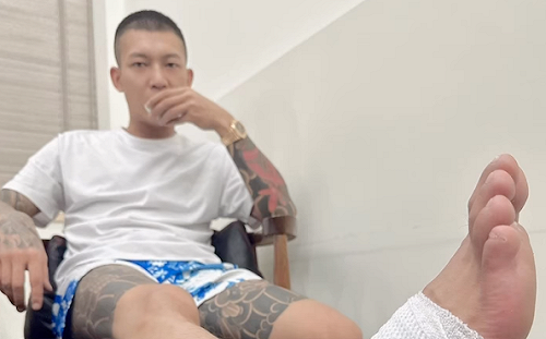 鳳梨挑戰跳抖音舞「腳扭到」  怒：誰叫我跳就封鎖誰