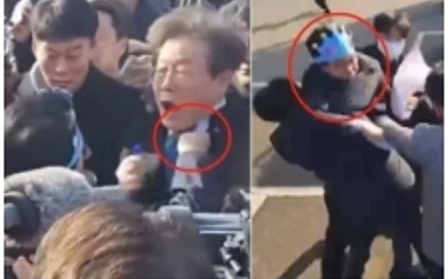 遭男子持30公分長刀行刺 李在明頸部受傷無生命危險 韓總統譴責暴力