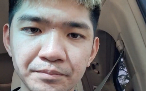 晚安小雞獄中過第二次生日！自曝身體出狀況：癢到受不了 