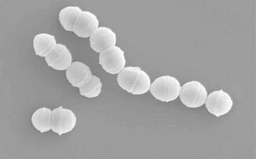 日本爆發A型鏈球菌疫情 疾管署：國內監測無異常
