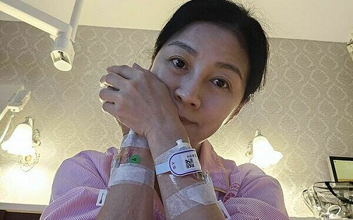 方文琳罹食道癌 自曝「2習慣」傷身！國健署教你3招自保