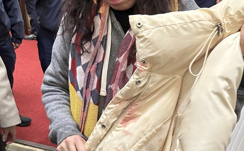 控陳玉珍鋼頭鞋猛踩她腹部 林宜瑾曝外套濺血照：台灣今天也淌血