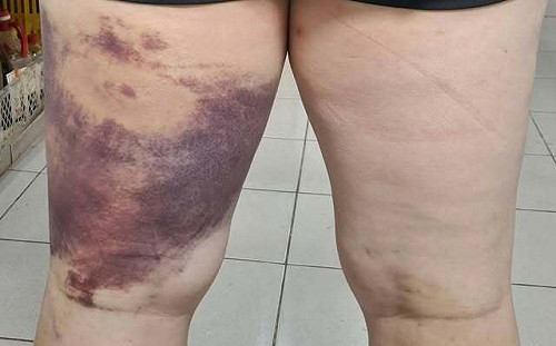 苗栗公民團體成員陳祺忠遭「買凶」教訓？ 1800字長文說感想