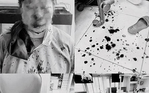 借錢不還找黑道打手暴打牙醫  主嫌百萬交保 施暴男聲押禁見