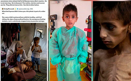 《紐時》承認誤用病童照片報導加薩饑荒! 哈瑪斯還製造兒童「吃樹葉」宣傳照