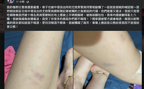 藝人侯沁潔稱財損破百萬將提告警方！網友諷刺「拒檢就閉嘴」