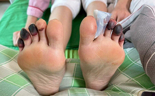 醫美亂象！抽脂竟釀腎衰竭、診所推卸：只是出借開刀房