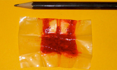 埃及男部落客郵購人工處女膜  挑戰社會禁忌