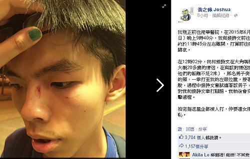 黃之鋒與女友遇襲受傷  寒心社運人士安全