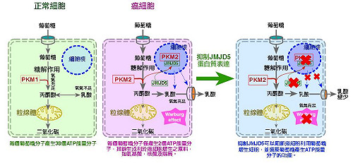 國衛院：癌症可能是新陳代謝疾病