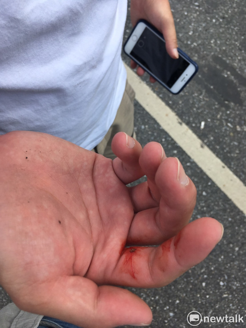 媒體記者在反年改遊行中手被打受傷。   圖：黃韋銓/攝