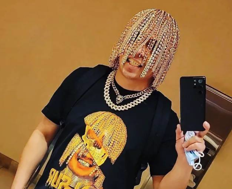 墨西哥饒舌歌手丹蘇爾（Dan Sur）將數十條金鍊子植入頭皮。   圖：翻攝自丹蘇爾IG