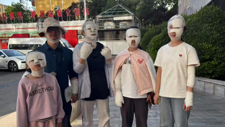 北京兩家人烤肉，卡式爐爆炸釀成７人受傷。   圖：翻攝自微博