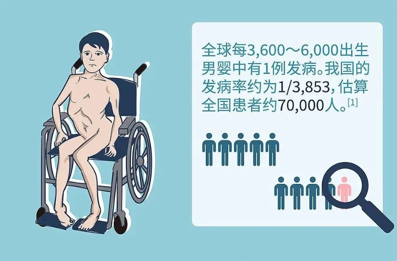 杜氏肌營養不良症(示意圖)。 圖:翻攝自華大基因官網 杜氏肌營養不良症(示意圖)。 圖:翻攝自華大基因官網