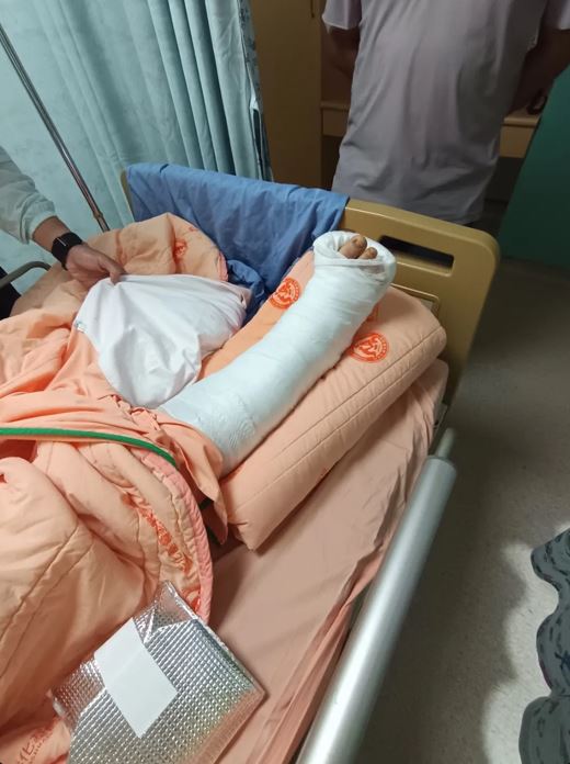 女國中生落地時腳沒踩好導致骨折。 圖:翻攝自Threads