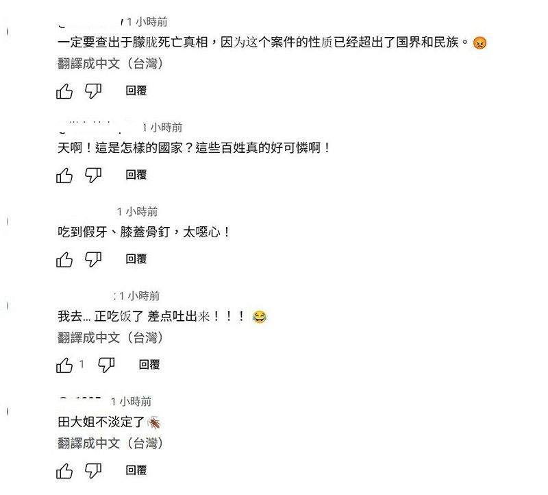 這件事引起很多網友討論,「吃到假牙、膝蓋骨釘,太噁心!」、「正在吃飯 差點吐出來!」 圖:取自YouTube頻道《大宇拍案驚奇》