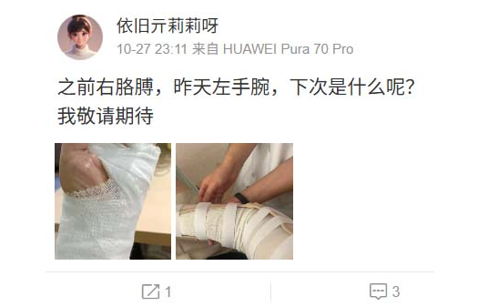 10月27日亓莉莉發出兩張包紥手臂的照片，「之前右胳膊，昨天左手腕，下次是什麼呢？」，疑似暗指受到不明人士攻擊。   圖：翻攝自亓莉莉微博