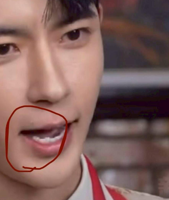 于朦朧生前的影片被發現後排牙齒幾乎消失，懷疑遭到拔牙虐待。   圖：翻攝自Threads