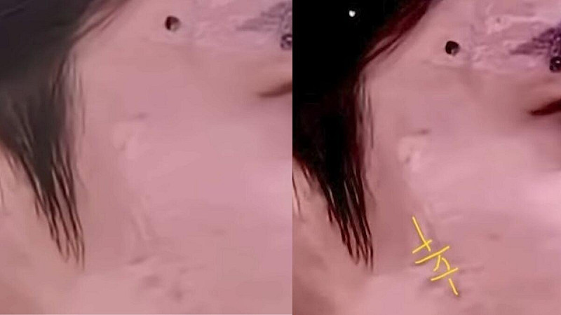 日前有網友爆料，指出于朦朧的臉出現了奇怪的「倒辛」字。   圖：翻攝自網路