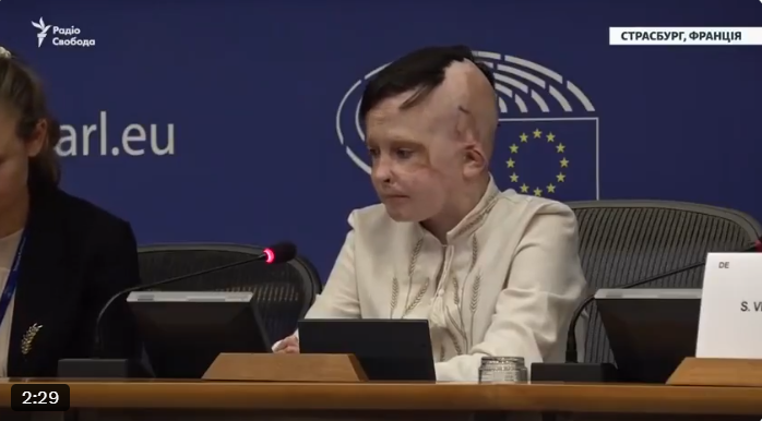 烏克蘭男孩羅曼在醫院遭俄軍炸傷，母親慘死。   圖：擷取自X@nexta_tv