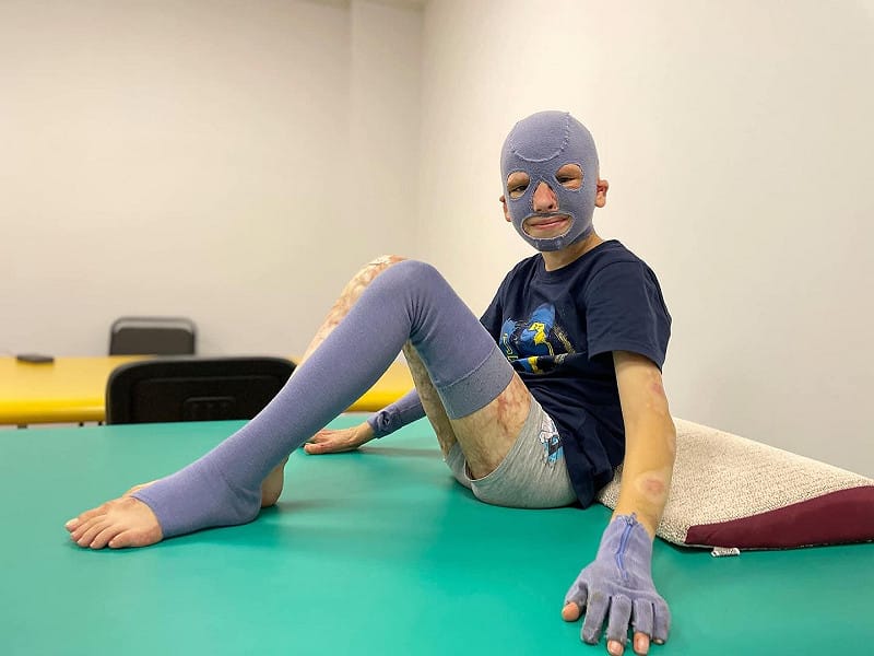 烏克蘭男孩羅曼在醫院遭俄軍炸傷，母親慘死。   圖：翻攝Ukraine.ua臉書