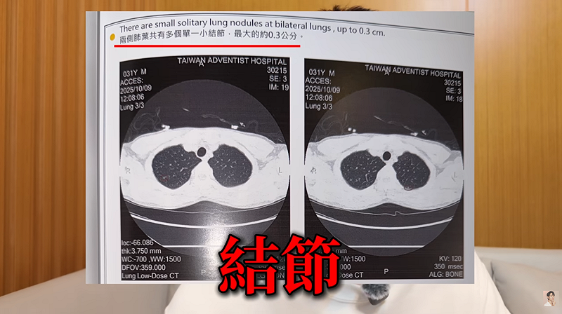 前陣子Andy去做健康檢查時，意外發現肺部長出了多個結節。&nbsp;&nbsp;&nbsp;圖：翻攝自Andy YT頻道