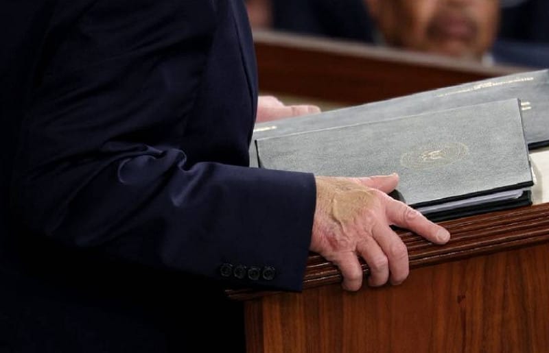 川普在國情咨文的演講中，仍可見右手背面的瘀青，疑似塗抹遮瑕膏刷淡。&nbsp;&nbsp;&nbsp;圖 : 翻攝自X / 方舟子