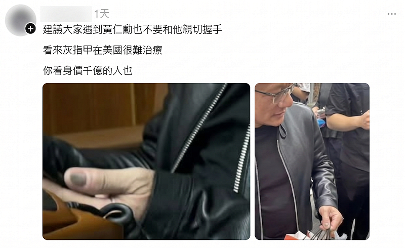 16日有網友在Threads貼出黃仁勳手部特寫，指其左手拇指灰黑似瘀青，質疑像灰指甲引發熱議。&nbsp;&nbsp;&nbsp;圖：翻攝自Threads
