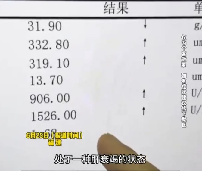 福建男子吃黃瓜竟然腎衰竭，出現葫蘆素中毒現象。&nbsp;&nbsp;&nbsp;圖 : 翻攝自光明日報