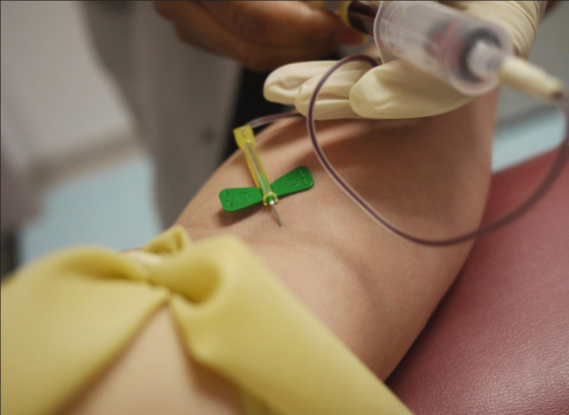 過往瘧疾需要利用血液檢測才能得知病患狀況。   圖：翻攝自Flickr 由Thirteen 授權