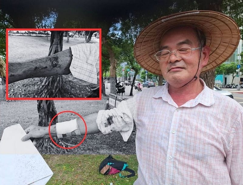楊木火7月19日前往信義區街頭舉牌陳抗，卻遭警方架離，過程不慎濺血。&nbsp;&nbsp;&nbsp;圖：楊木火/提供（新頭殼製圖）