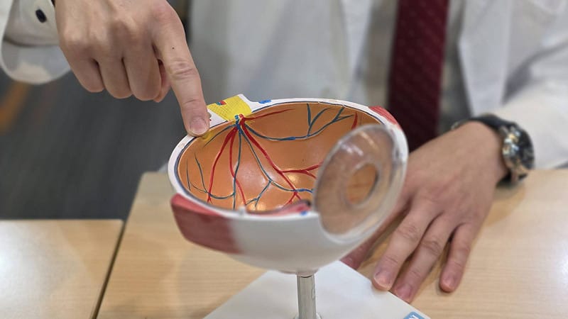 病患陳先生的眼腫瘤位置在黃斑部旁邊（長庚醫院提供）&nbsp;&nbsp;&nbsp;圖：長庚醫院／提供