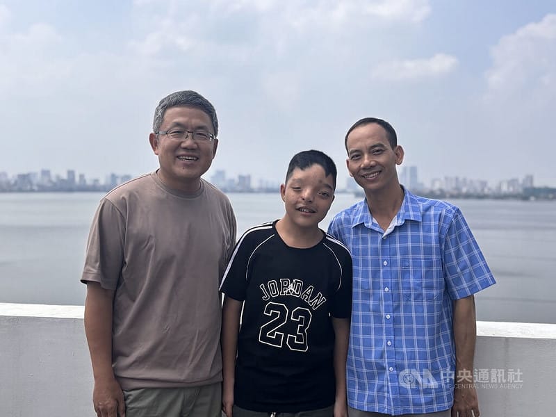 羅慧夫顱顏基金會自1998年開始來越南義診，迄今幫助超過500名孩童重拾正常生活、重建自信。男孩阿清（中）與父親阿雄（右）剛從台灣回來，開心應駐越南代表劉世忠（左）之邀前來慶中秋。中央社記者曾婷瑄河內攝115年9月21日&nbsp;&nbsp;&nbsp;圖：中央社提供