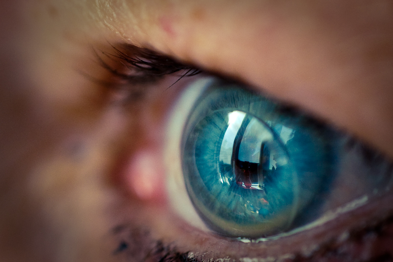 韓國研究團隊近日發明隱形眼鏡葡萄糖檢測器，讓患者不需要再扎手指做檢測，未來可望商業化。   圖：翻攝自Flickr 由Niek Beck授權