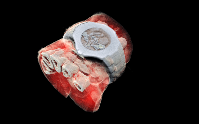 3D彩色立體X光片將改變未來醫療。   圖：翻攝CERN