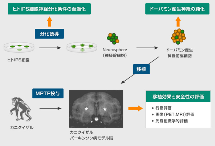日本政府批准以誘導性多功能幹細胞（iPS細胞）製成神經細胞，移植到帕金森氏症患者腦內的臨床實驗計畫。   圖：翻攝京都大學iPS細胞研究所