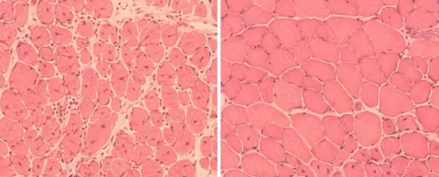 科學家利用細胞重編讓動物的老化逆轉。   圖 : 翻攝自3g.163.com