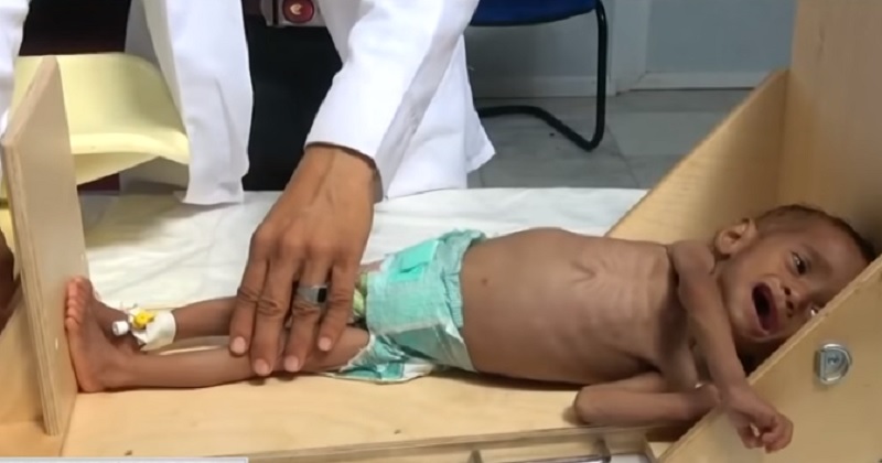 葉門爆發內戰3年，多達8萬5000名5歲以下孩童因饑荒或疾病而死。   圖：翻攝Youtube