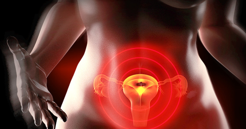 中山醫院主治醫師郭安妮指出，子宮肌瘤分為單發性和多發性2種，前者為子宮內長單一肌瘤，而這名患者則屬於多發性的子宮肌瘤，即子宮裡同時長出多顆肌瘤。   圖／ingimage