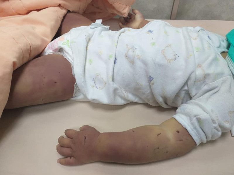 殘忍至極! 台南遭虐死女童驗屍體無完膚    圖：取自飆悍臉書