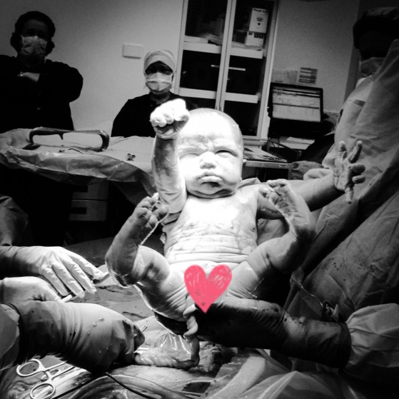 澳洲一名小男嬰在出生時擺出超人姿勢，讓大家會心一笑。   圖／翻攝自每日郵報