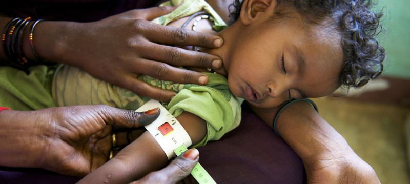 近東與北非國家戰亂頻傳，相關單位正為1名嚴重營養不良的蘇丹兒童做治療。   圖：聯合國圖片/Shehzad Noorani
