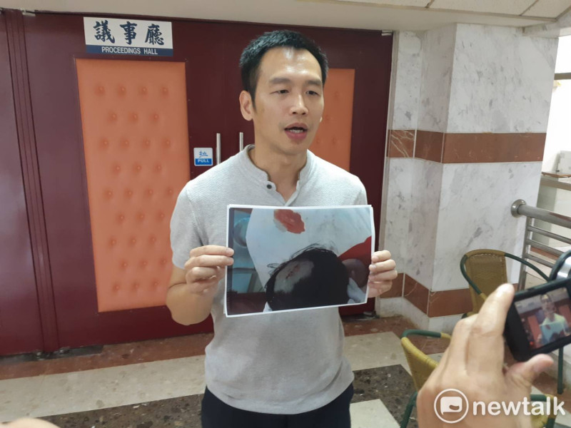 嘉義市議員鄭光宏今天在市議會表示，一名男童在共融遊戲場遊玩時，頭部遭割傷8公分。   圖：蔡坤龍/攝