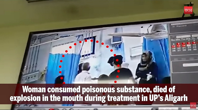 印度發生離奇醫療意外,女子中毒送醫急救竟爆頭身亡。 圖/翻攝自TOF新聞影片