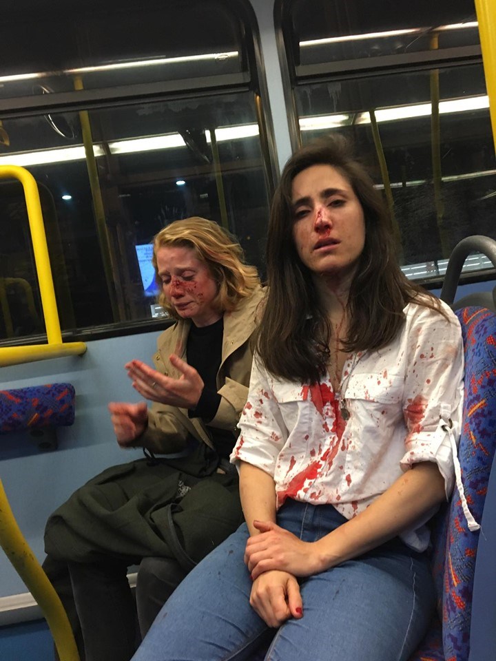 英國一對女同志情侶搭乘倫敦夜間巴士遭到言語騷擾，還被打得頭破血流，令各界震驚。   （圖取自facebook.com/melaniapeese）
