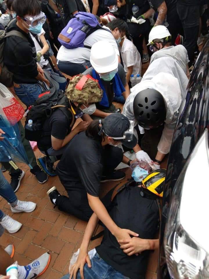 反送中抗爭現場，一位民眾眼睛遭港警擊中。   圖 : 翻攝自Leung Chi Wing 臉書
