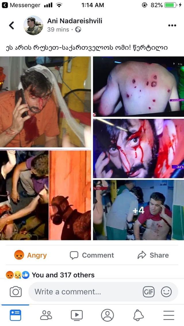 有民眾拍下遭橡膠子彈射中的抗議人士照片，滿臉是血，全身都是傷痕   圖：翻攝自Ani Nadarrishvili推特