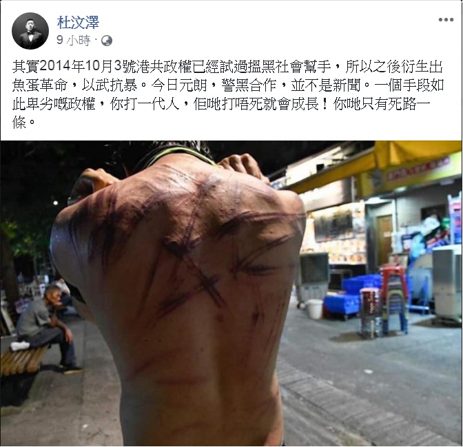 香港反送中爆發元朗白衣人無差別攻擊事件，港星杜汶澤在臉書PO出一張民眾背部傷痕累累照片，直指在元朗的白衣人根本是「警黑合作」。   圖：翻攝杜汶澤臉書