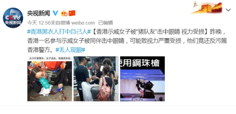 11日晚間，有一名女子眼部遭港警以布袋彈射擊，布袋彈射穿眼罩，緊急送醫後傳出右眼永久失明，然而，中國官媒對此竟稱該名女子是遭「豬隊友」射擊，反批示威者汙衊香港警方。   圖：翻攝自央視